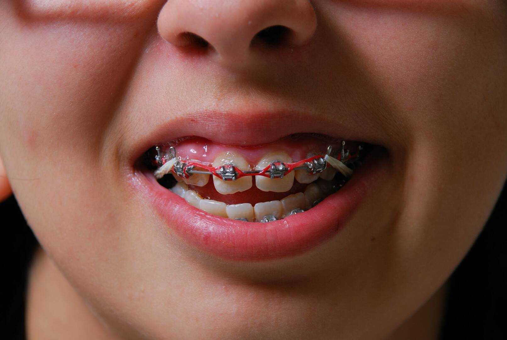 Keystone Dentistry is an Expert Cosmetic Dentistry in Indianapolis, IN