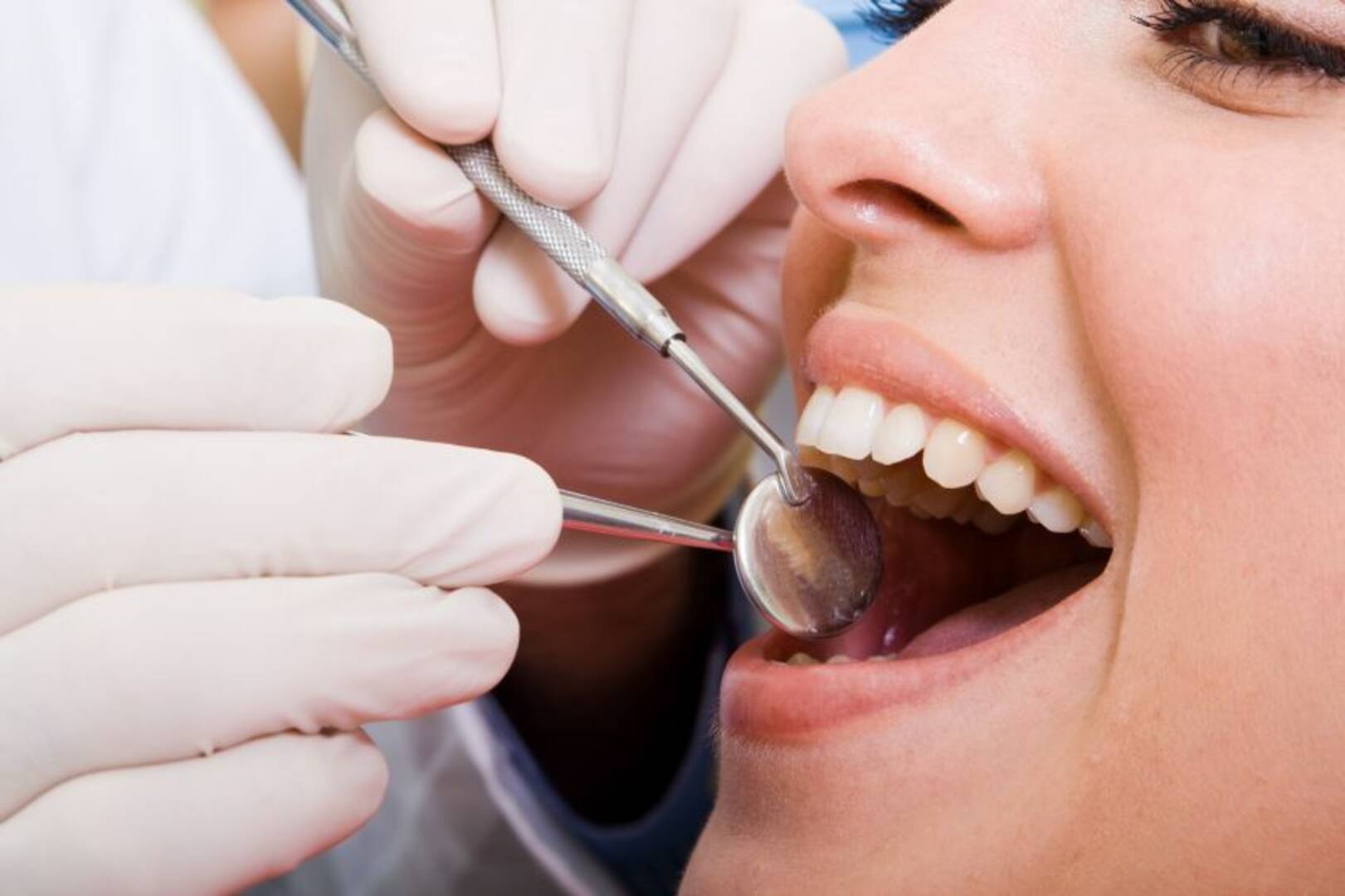 Tooth Extractions Otara Papatoetoe Area